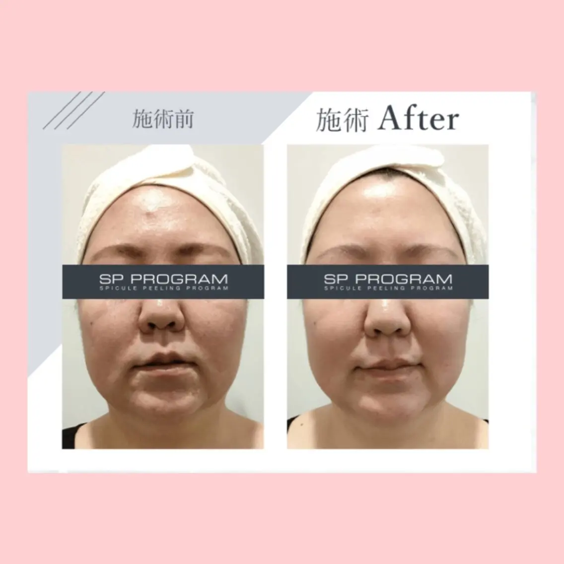 その他 Palum Airiのその他イメージ