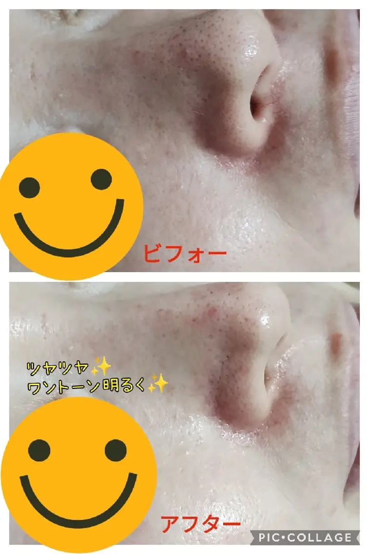 beauty  salon 向日葵のエステ・リラクイメージ