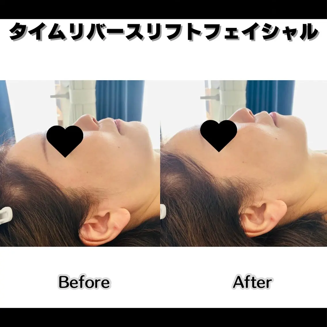【半額以下!お一人様一回限り!】タイムリバースリフトフェイシャル(ベーシックケア)の写真