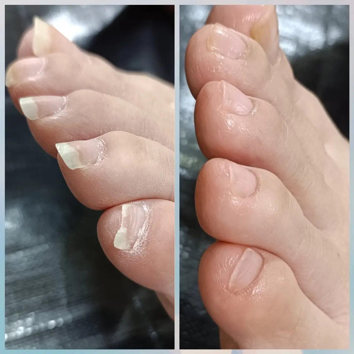 ネイル フットネイル フットネイル その他(ネイル) 最終受付23時半 benny nailのネイルデザイン
