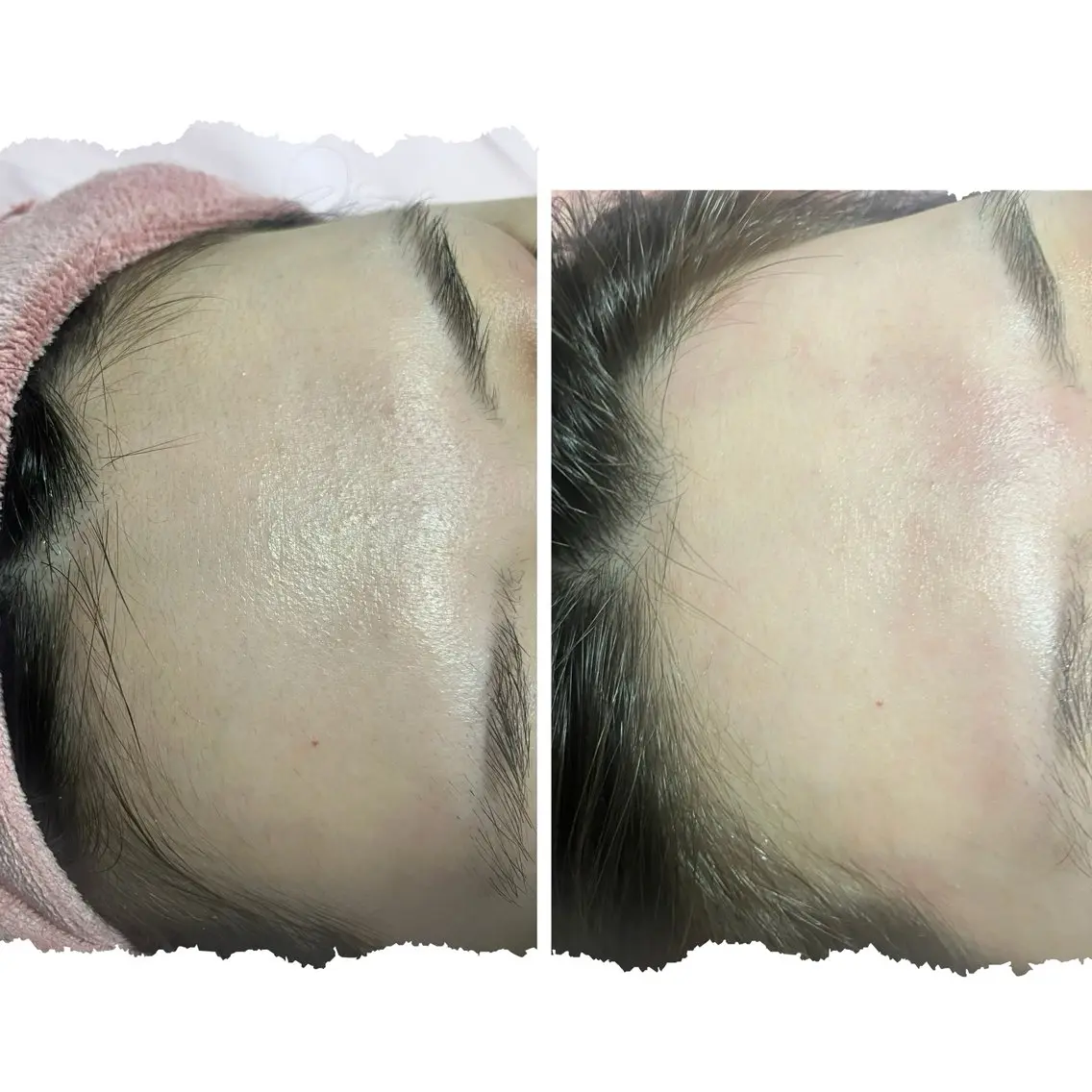 ウルツヤ肌に✨フェイシャルWax ￥8800 60分の写真