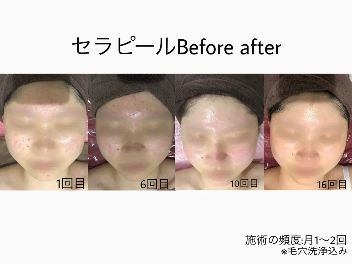 エステティックサロン Viveのエステ・リラクイメージ