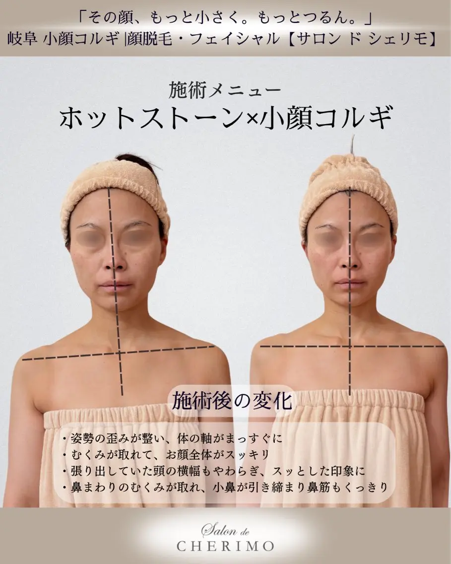 【50分】即!!効果実感【身体から根本改善小顔コルギ】ブライダルを控えている方にもおすすめ♪※お着替えカウンセリング別の写真