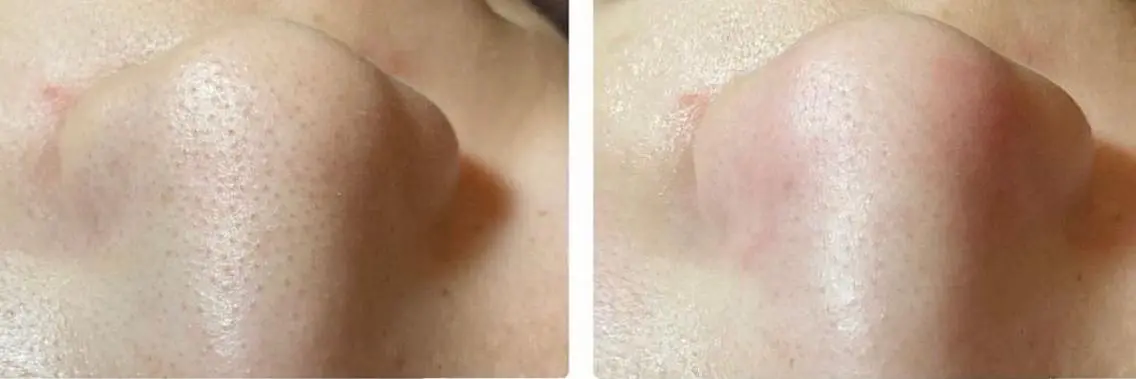 メンズ beauty salonnのエステ・リラクイメージ