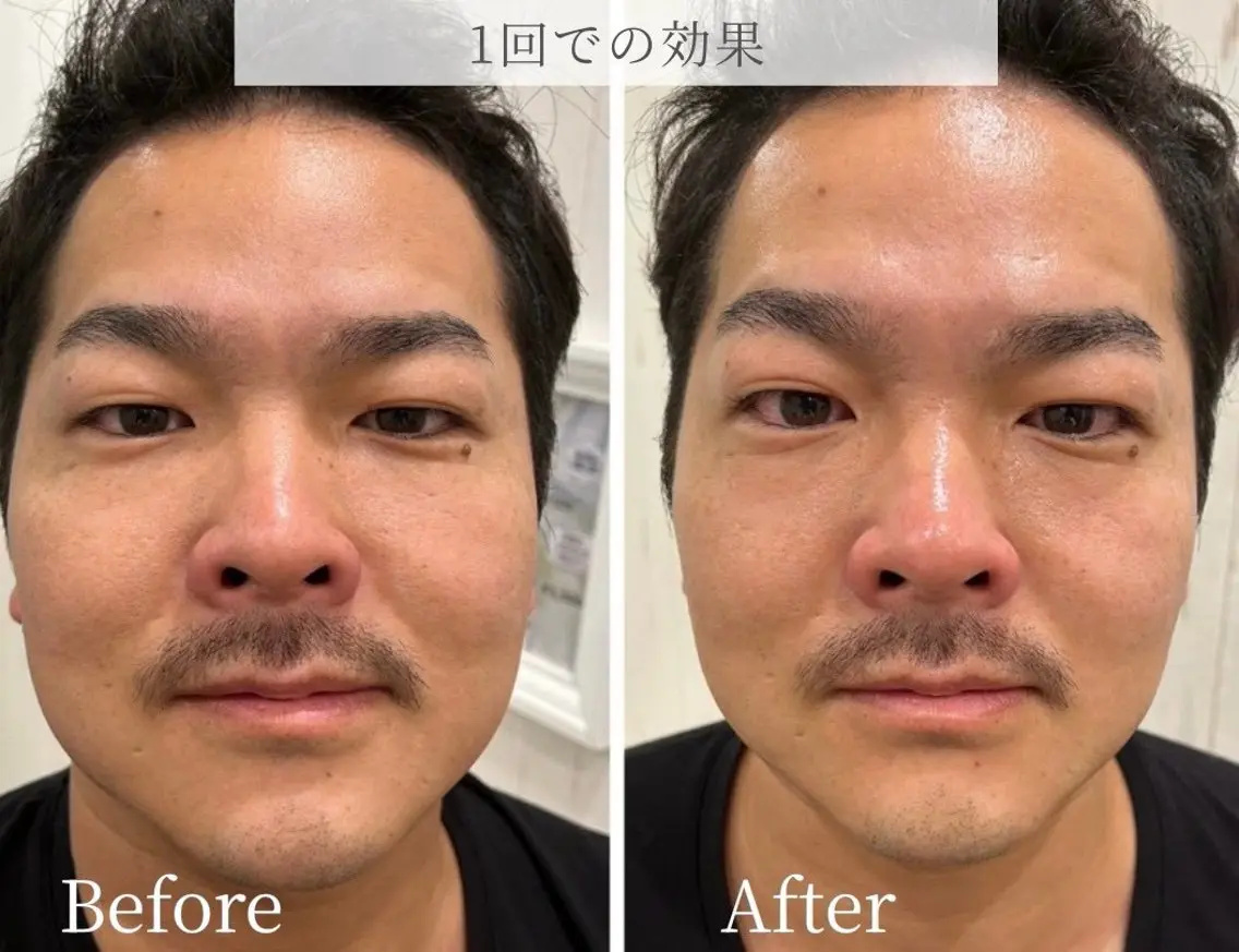 エステ リラク brillio小顔 たるみケア 菜央のエステ・リラクイメージ