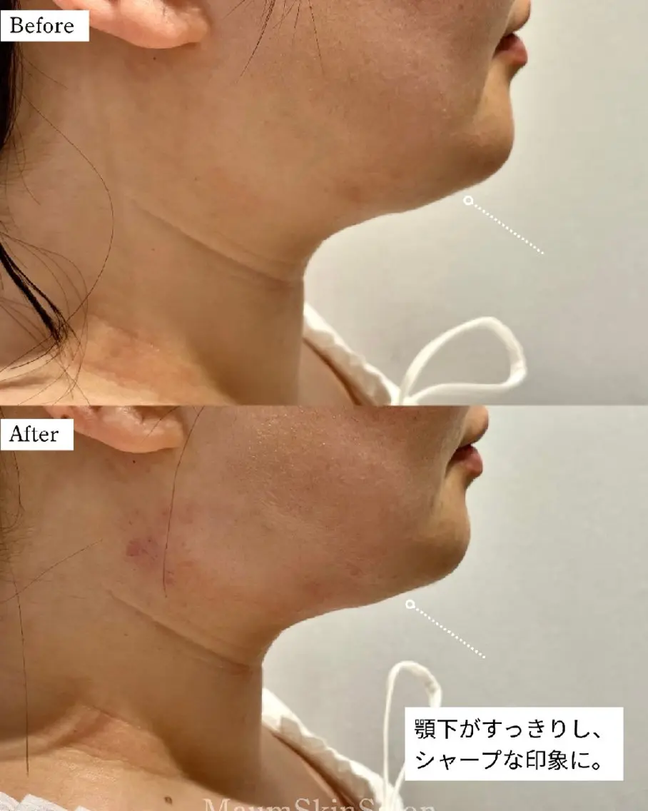 エステ Maum SkinSalonのエステ・リラクイメージ