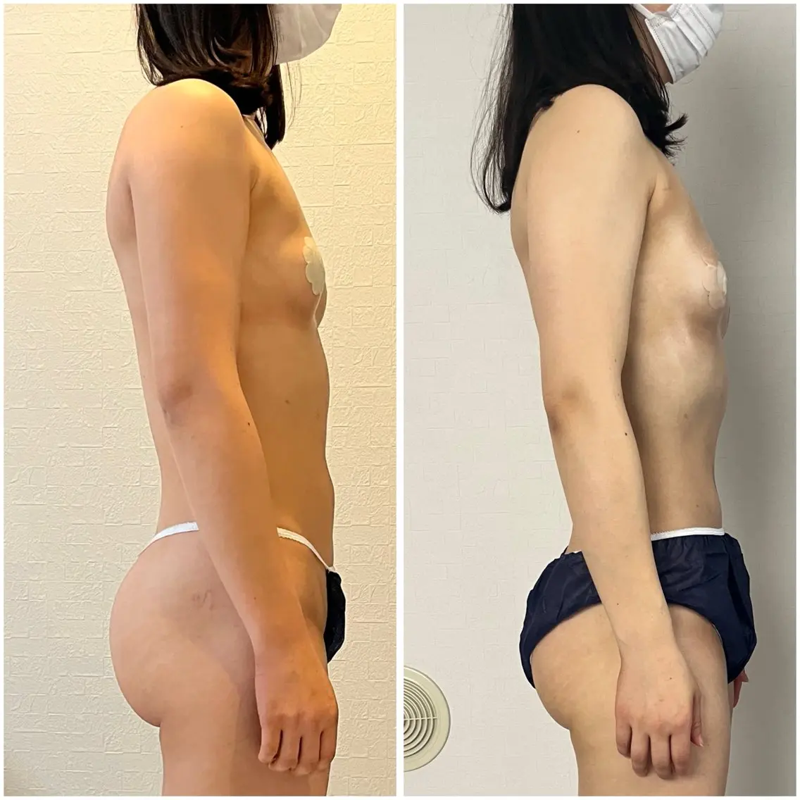 湘南エステサロン moaのエステ・リラクイメージ