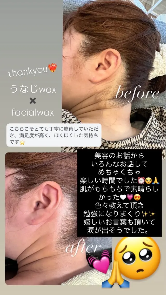 脱毛 Re.lien 白子菜美のエステ・リラクイメージ