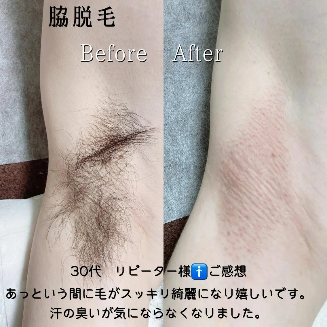 メンズ 脱毛サロン KiWiのエステ・リラクイメージ
