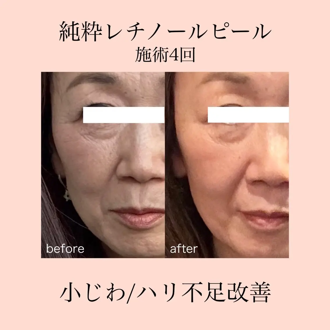 エステ 肌質改善×癒しサロン Ryanのエステ・リラクイメージ