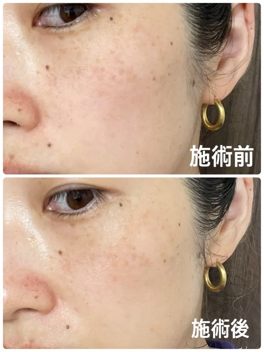 坂田(山下) 澄香のネイルデザイン