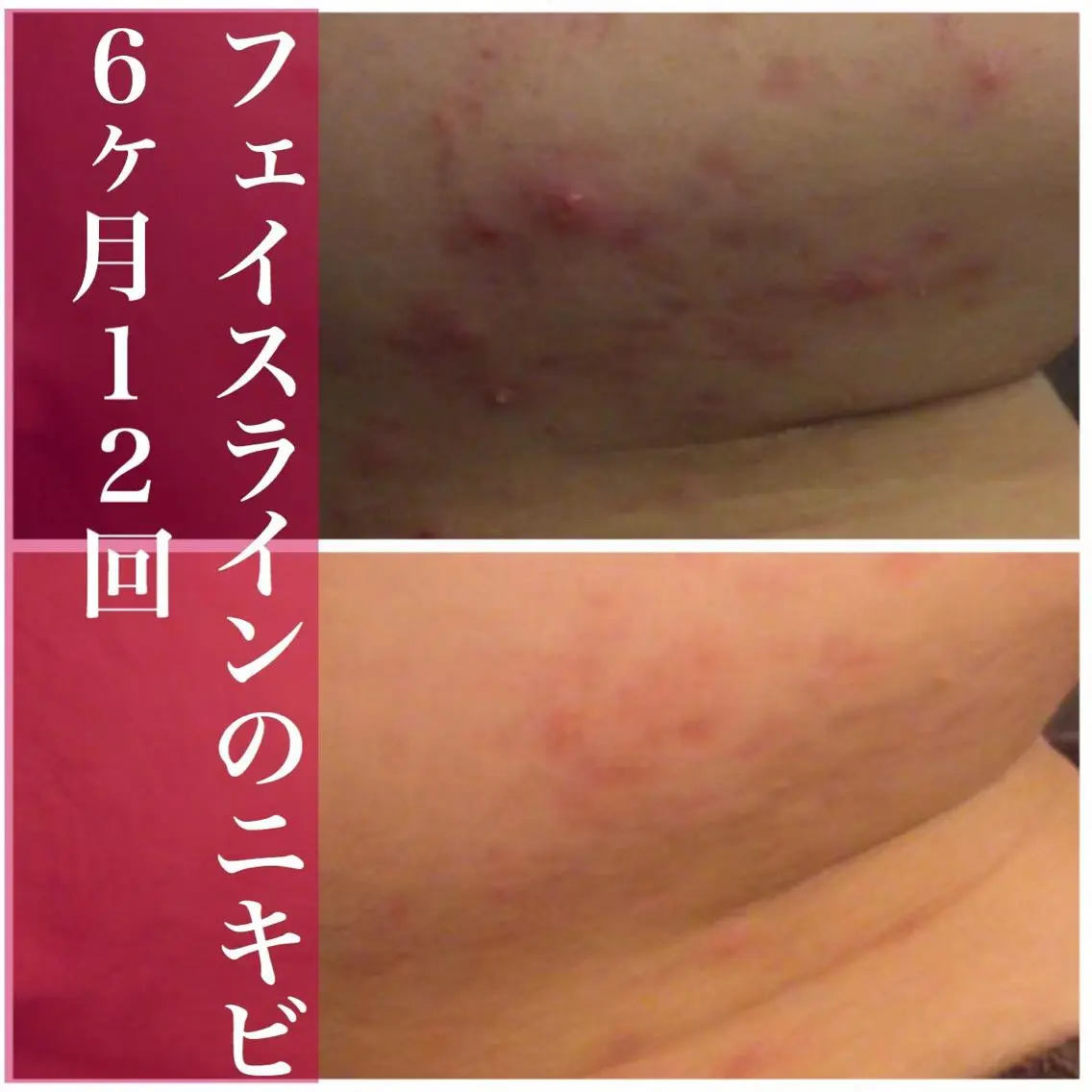 ミディアム カラー パーマ ヘアアレンジ メンズ キッズ ネイル マツエク・マツパ アイブロウ エステ リラク ニキビ・肌質改善専門 ♡人生が変わるサロンのエステ・リラクイメージ