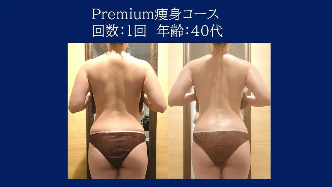 痩身×体質改善 【美方】のエステ・リラクイメージ