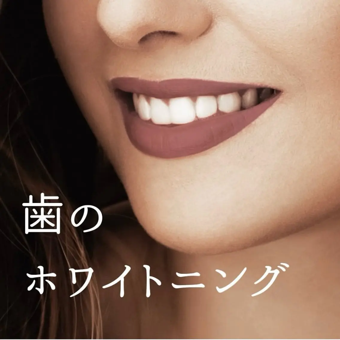 【初回】セルフホワイトニング 15分照射×2回の写真