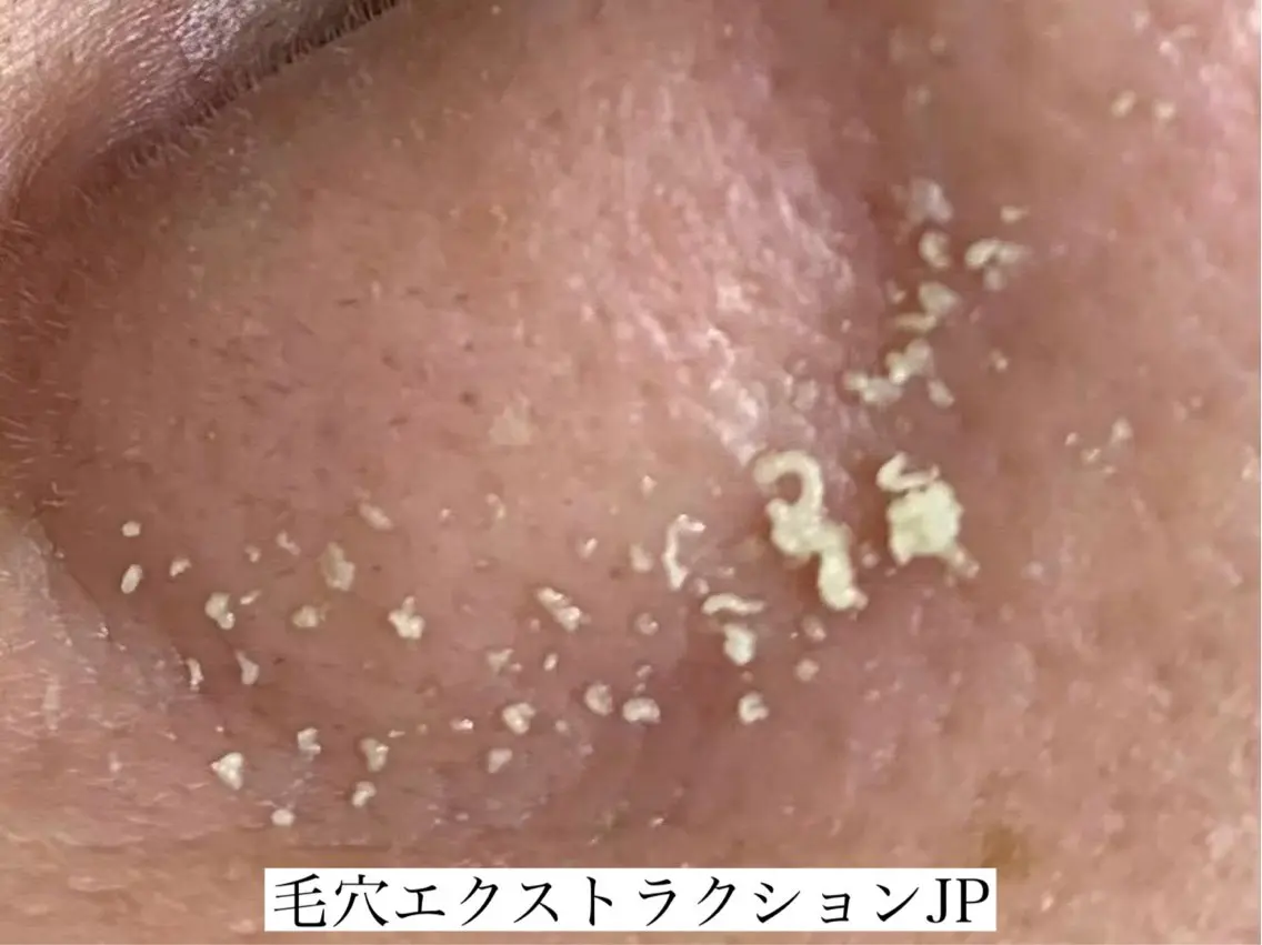 エステ 佐々木 風奈のエステ・リラクイメージ