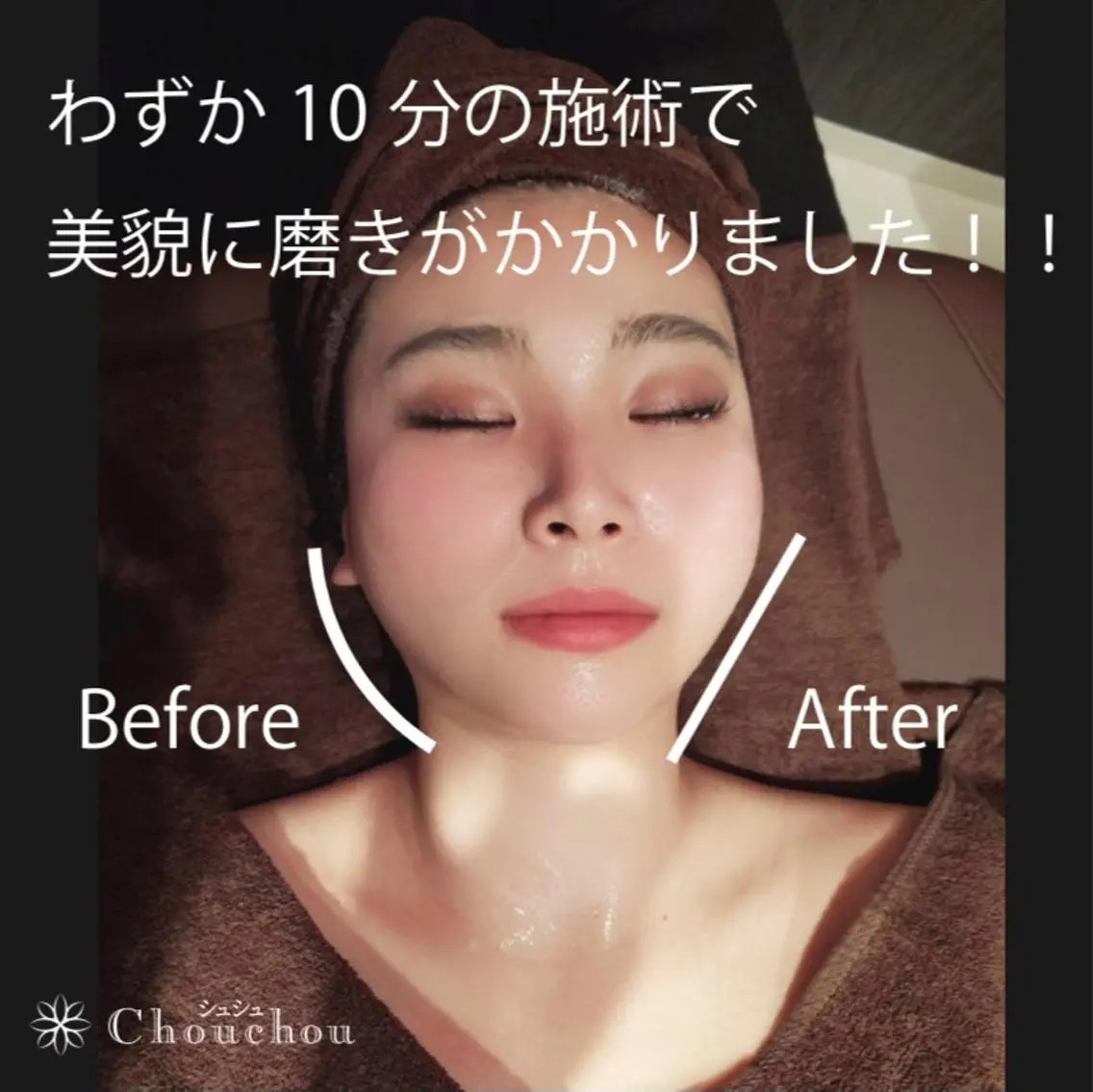 痩身・小顔・美肌専門 Chou chouのエステ・リラクイメージ