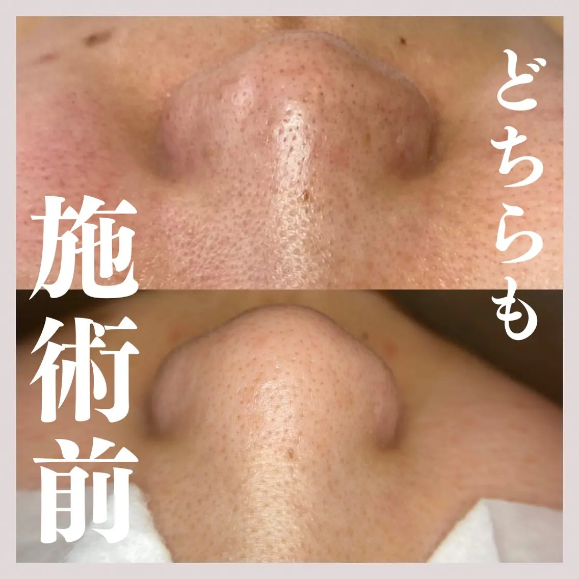 エステ salon MUSUBUのエステ・リラクイメージ
