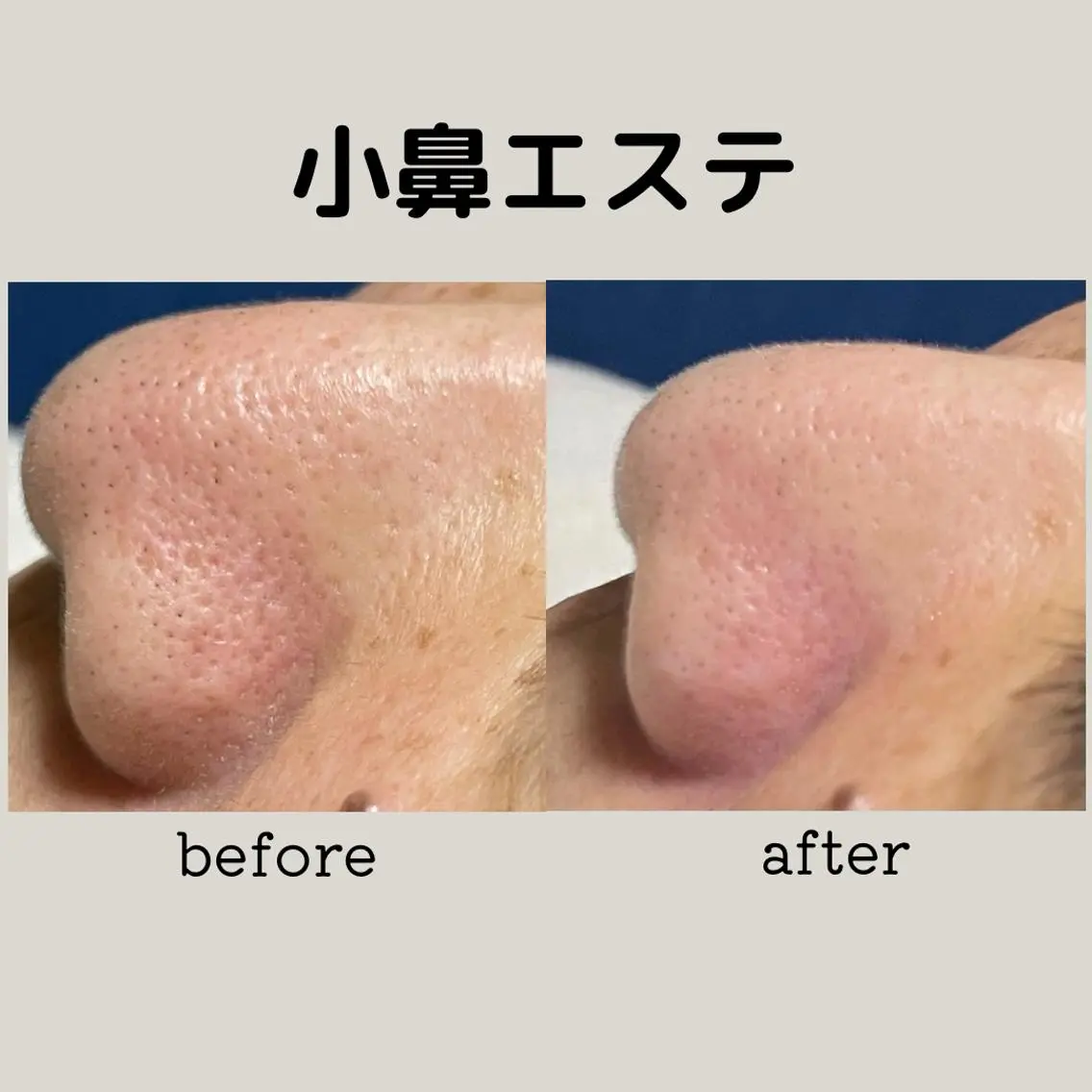エステ 小林 玲菜のエステ・リラクイメージ