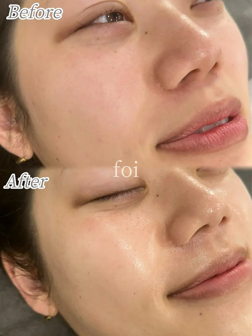 エステ 艶肌デトックス🫧 Samiraのエステ・リラクイメージ