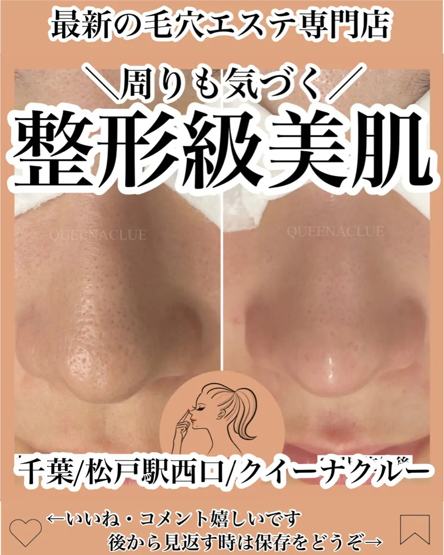 毛穴エクストラクションプロ/長年のいちご鼻から卒業/毛穴のザラつき/黒ずみ/毛穴の開きにも◎極上マッサージ付きの写真