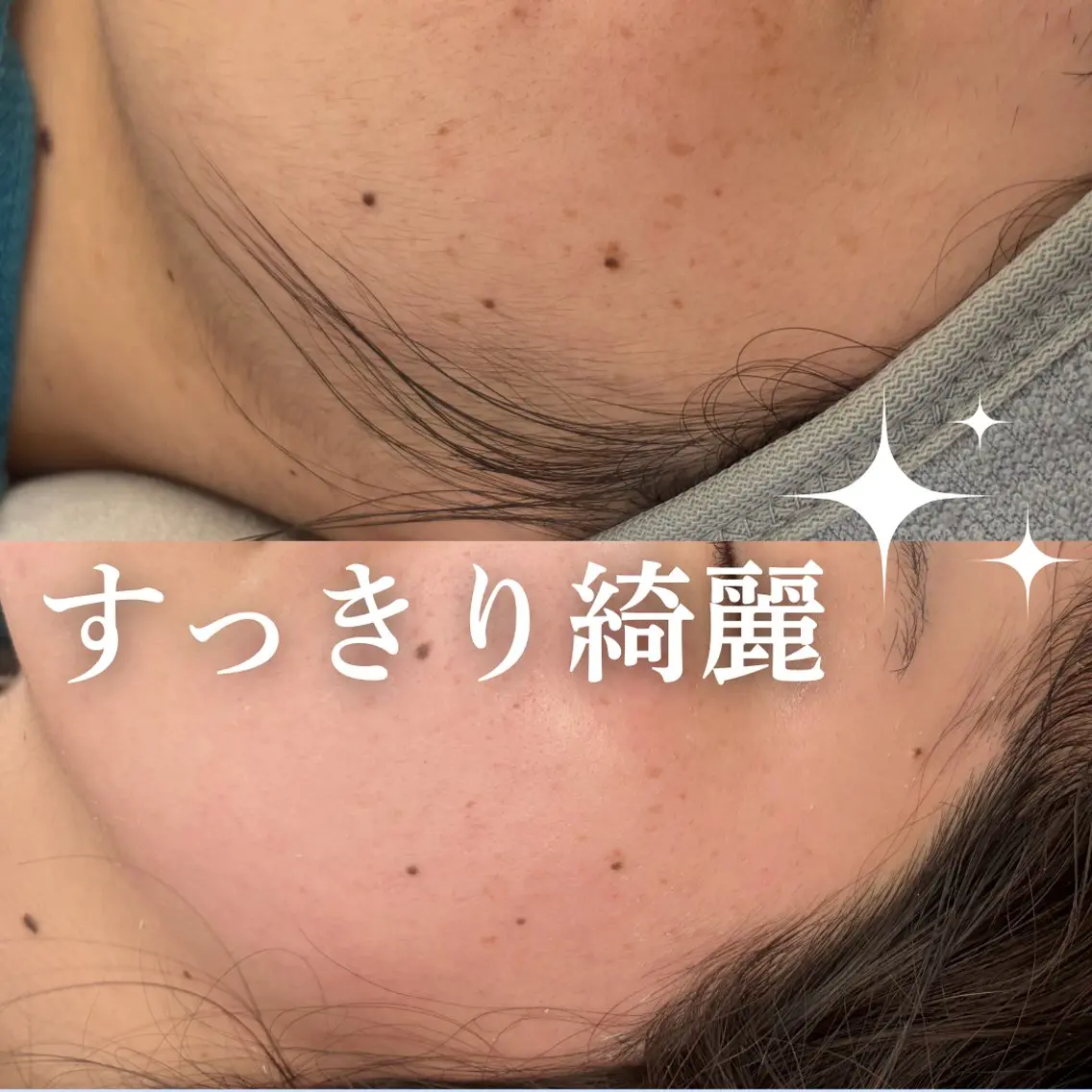 【つるん肌爆誕✨】フェイシャルワックスの写真
