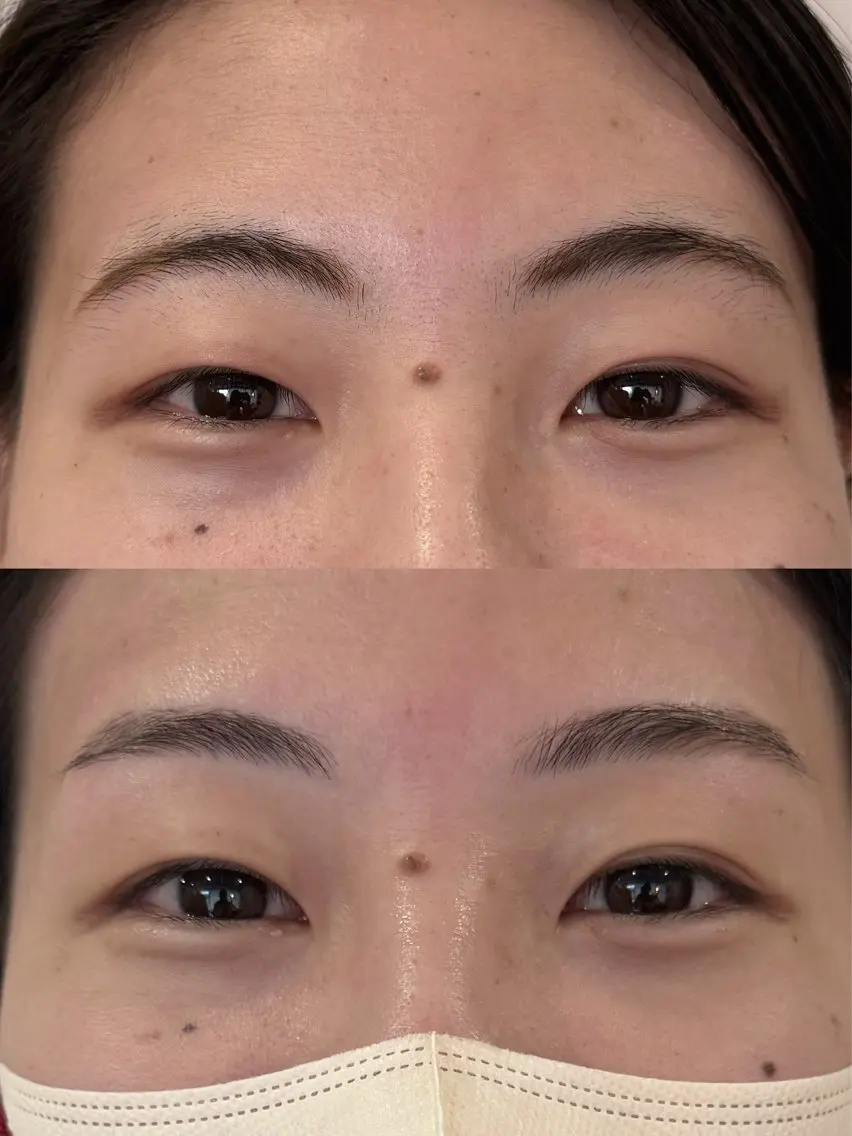 アイブロウ 眉毛ワックス脱毛 桐岡 莉紗の眉毛・アイブロウイメージ