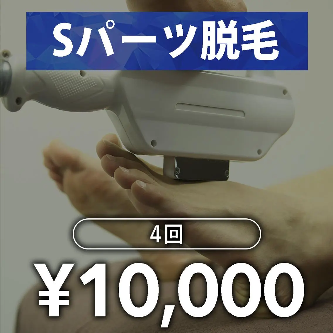 【メンズ脱毛】Sパーツ脱毛 4回 (組み合わせ自由)の写真