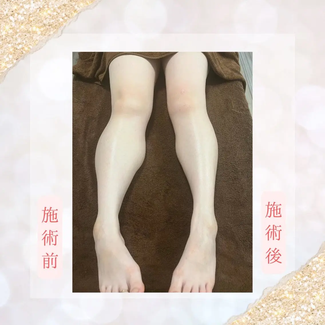cocorela 森脇奈美のエステ・リラクイメージ