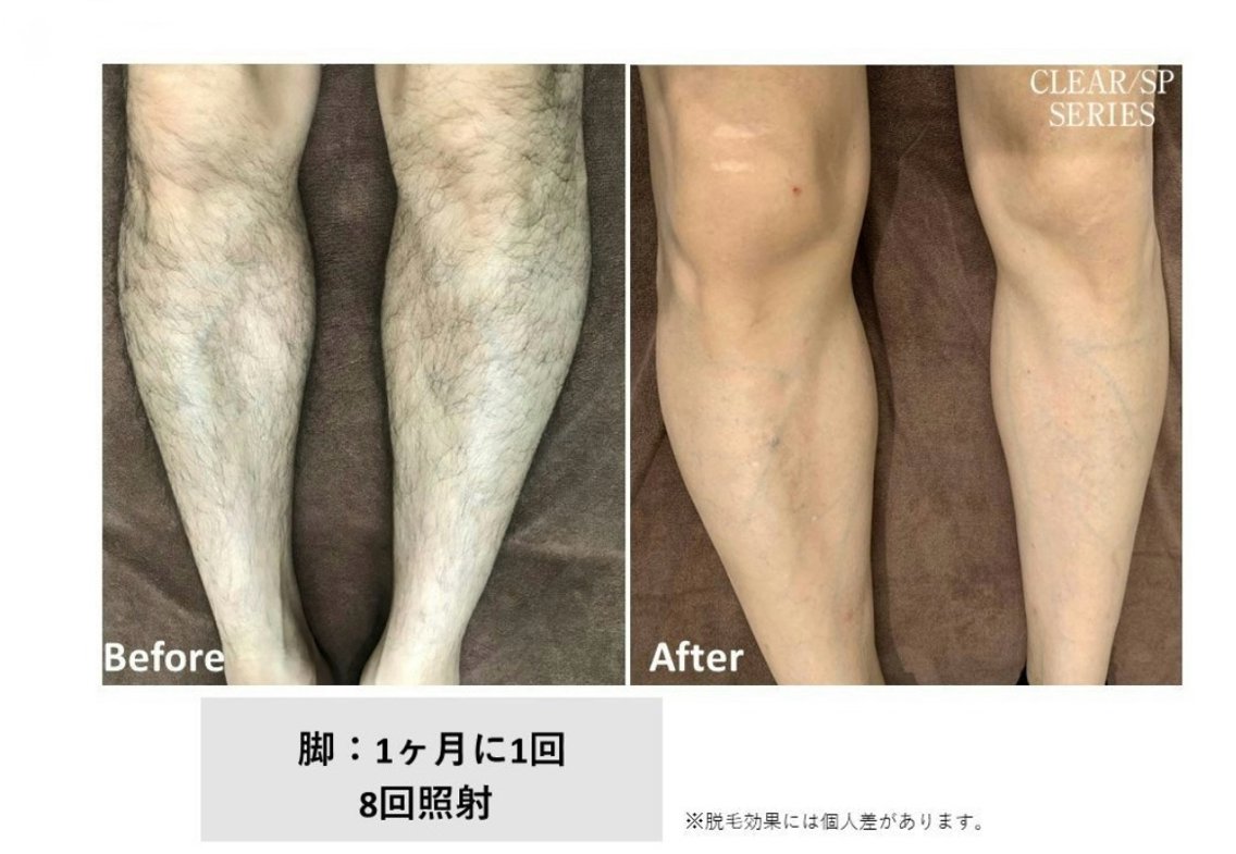 アトリエリリー 宅井のエステ・リラクイメージ
