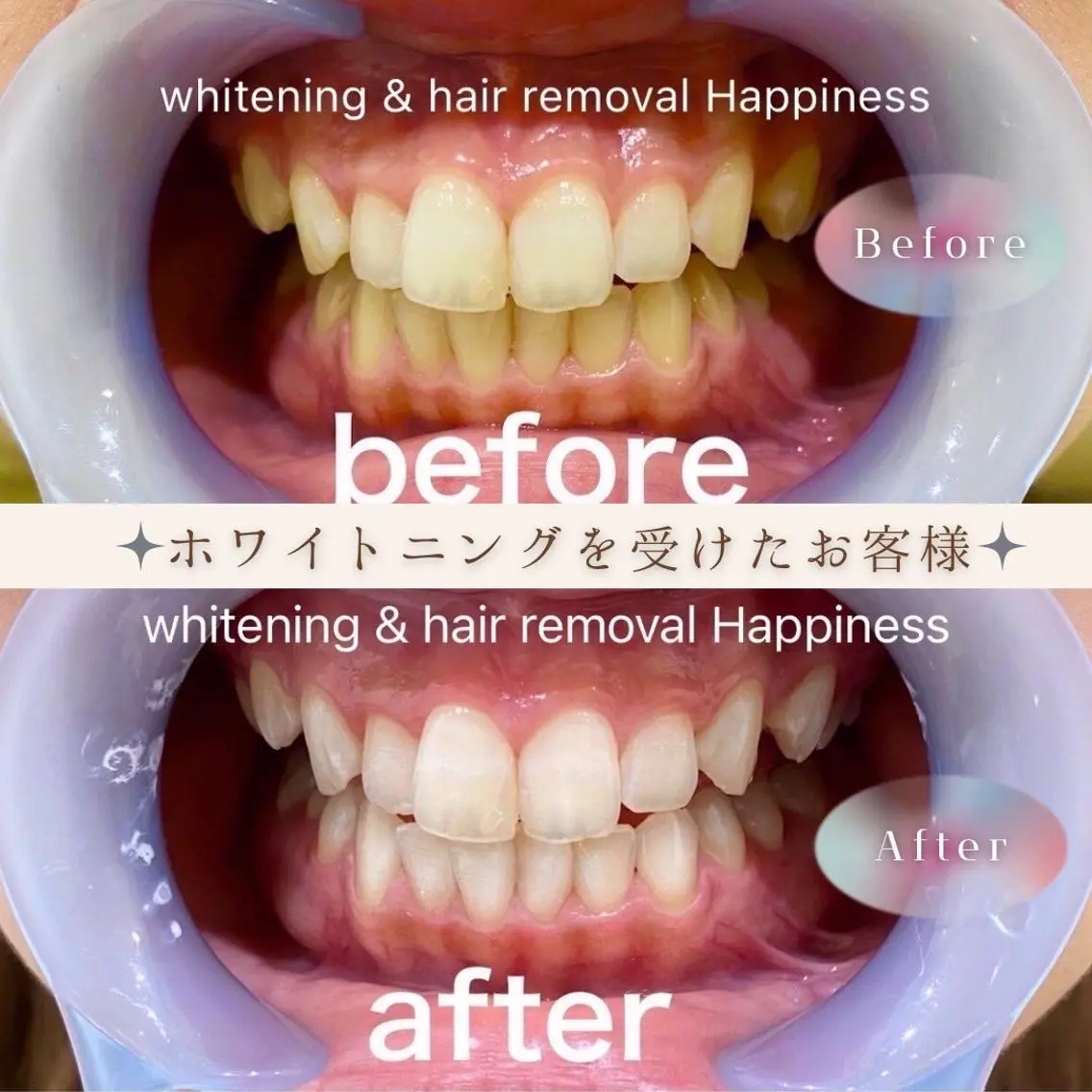 メンズ その他 Happiness 広島並木通り店のその他イメージ