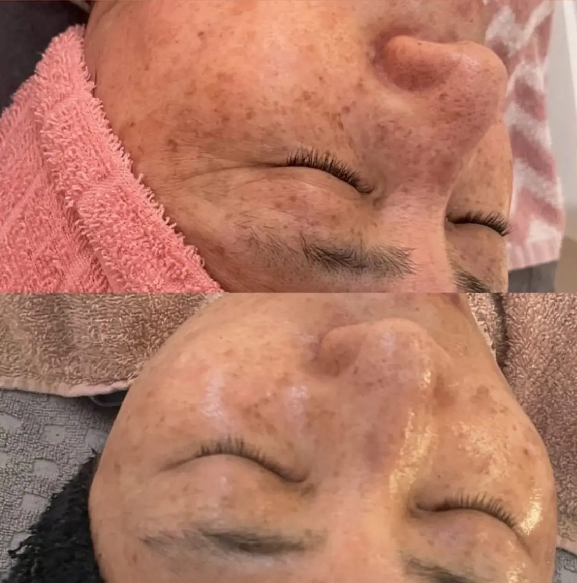 beauty lanaのエステ・リラクイメージ