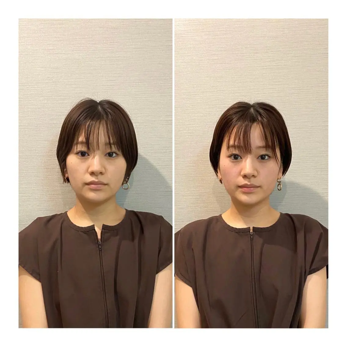 ショート その他 即小顔♥️美容鍼× ハーブピーリングのその他イメージ