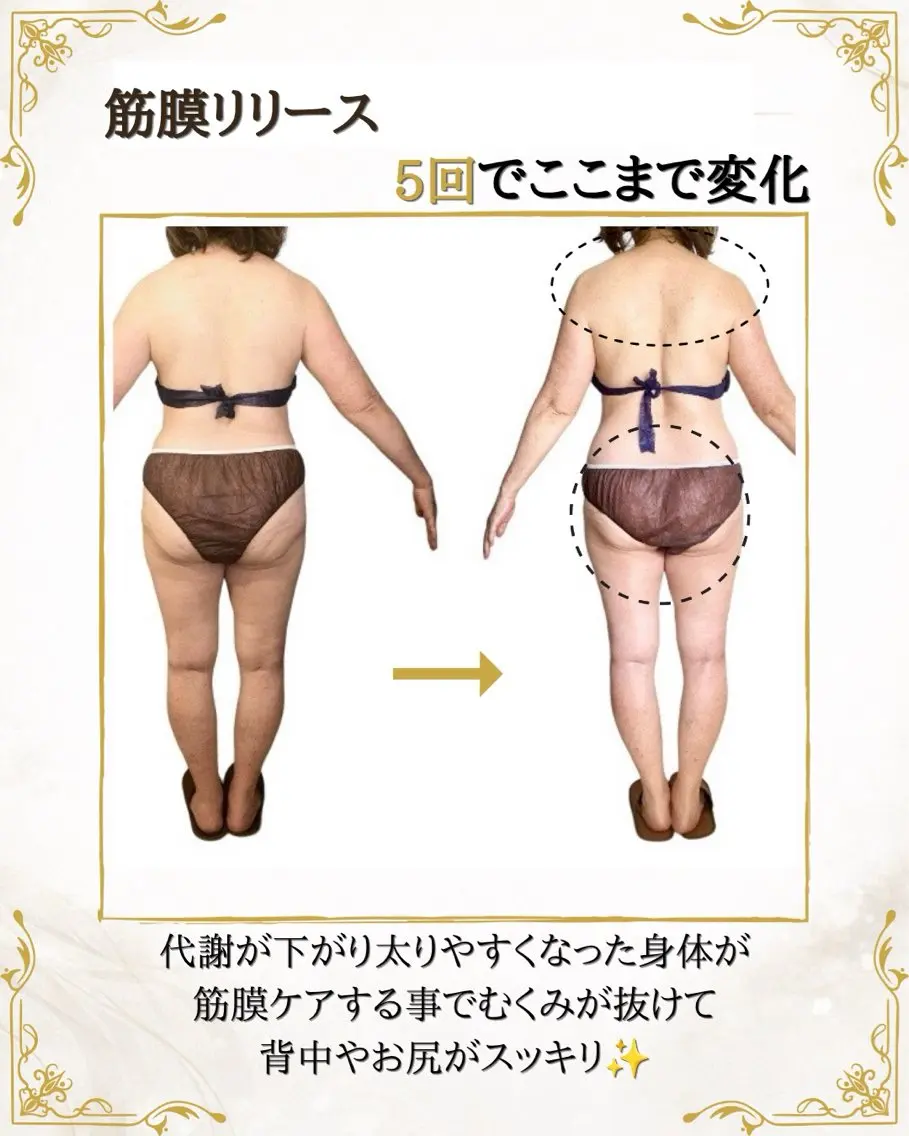 筋膜×深部温熱 リラク★痩身RIONのエステ・リラクイメージ