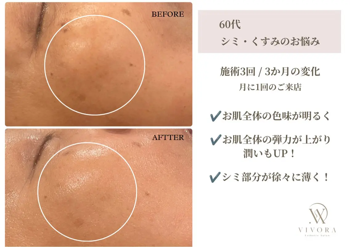 エステ VIVORA ASAMI🌿のエステ・リラクイメージ