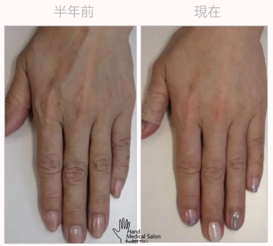 ネイル オーナーネイリスト 宮添華里のネイルデザイン
