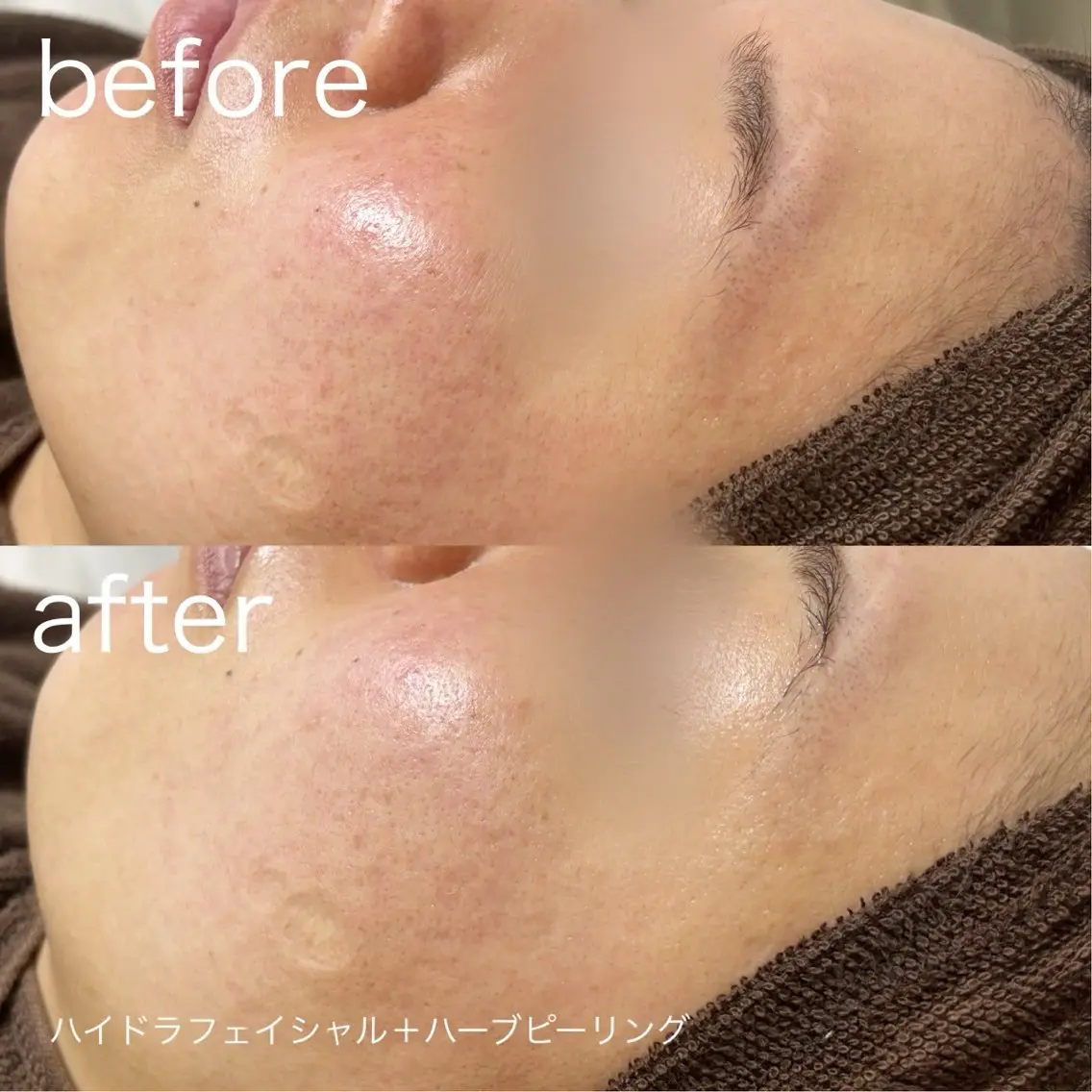 脱毛 lulularico Yuのネイルデザイン