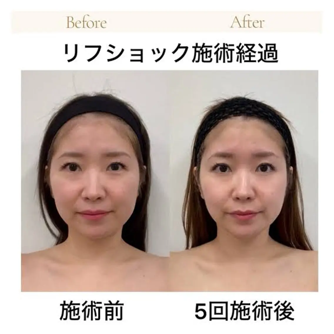 エステ 本物志向サロンTR ANSBEAUTYのエステ・リラクイメージ