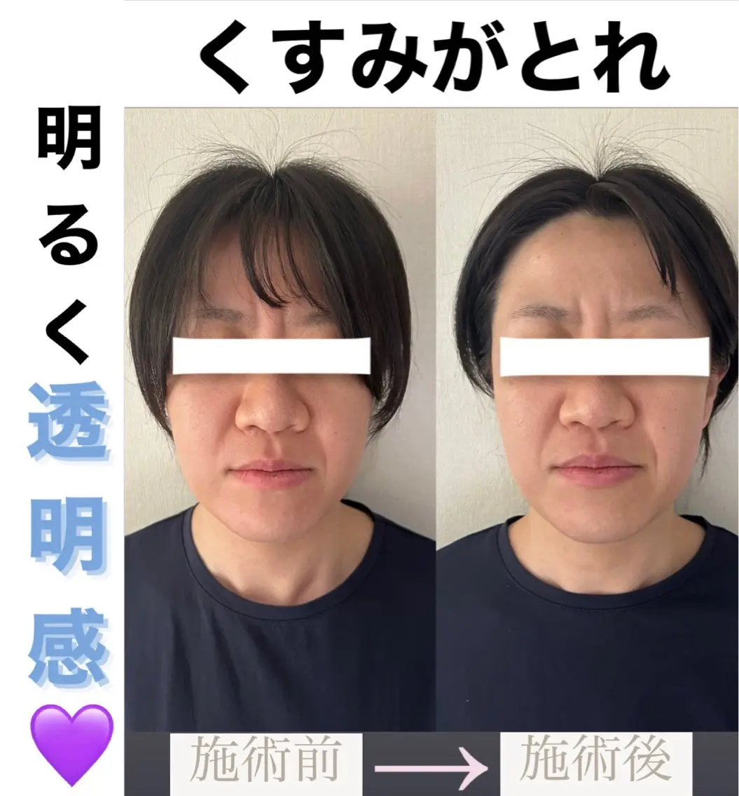 脱毛&美容サロン BLUESEAのエステ・リラクイメージ