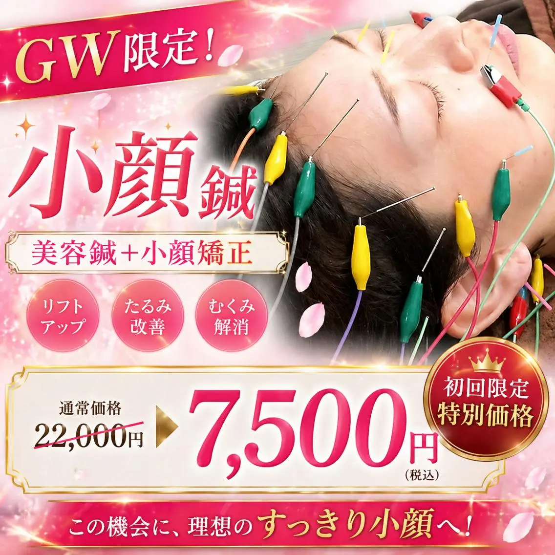 【美容鍼・小顔鍼】 鍼灸師 吉田洋美のエステ・リラクイメージ