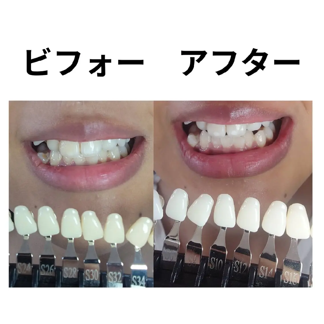 ホワイトニングサロン MYS自由が丘店のその他イメージ