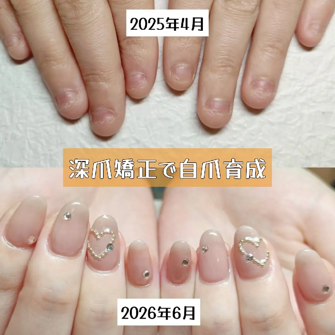 ネイル ハンドネイル ハンドケア 深爪矯正/爪育成ケア manie nailのネイルデザイン