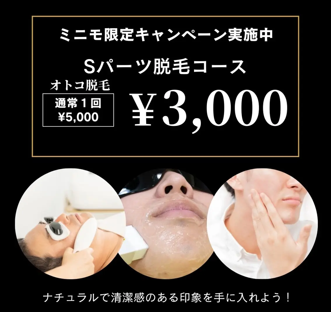 ヒゲ🥸脱毛したい‼️男性必見👀‼️初めてでも安心♪フェイシャル脱毛💆Sパーツ脱毛1回¥3,000の写真