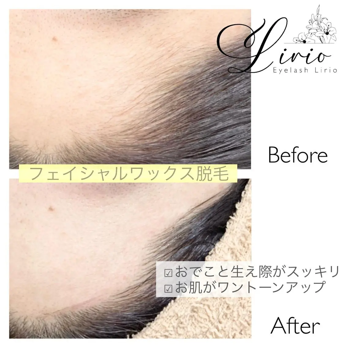 脱毛 EyeLash Lirio リリオのエステ・リラクイメージ