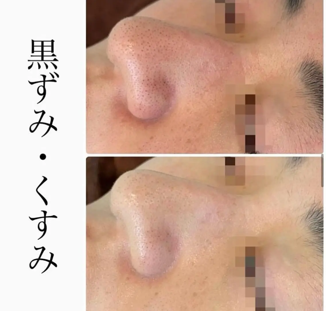 エステ ハーブピーリング専門 BIOPLUS+川崎のエステ・リラクイメージ