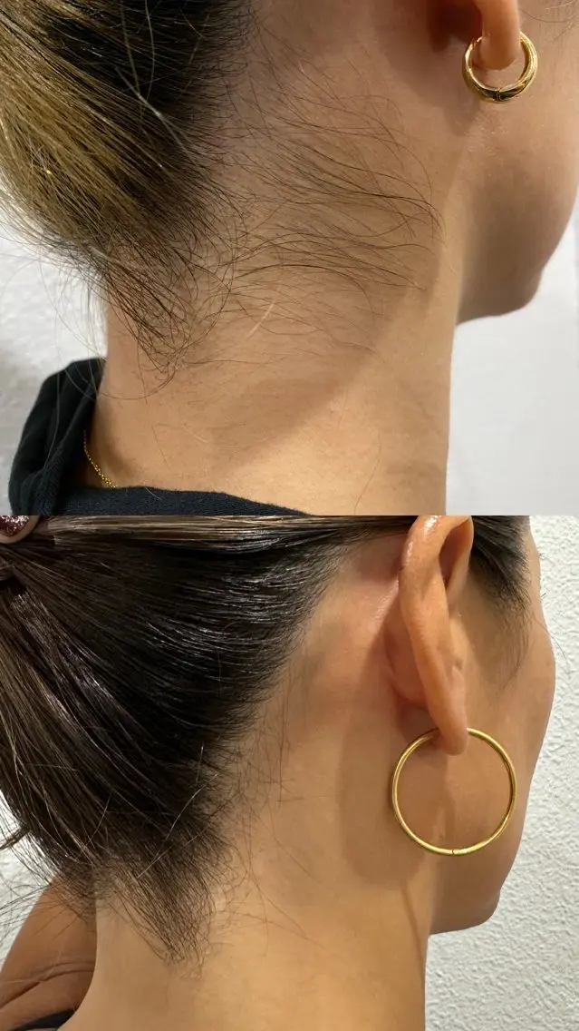 脱毛 パーソナル脱毛 GROOMのエステ・リラクイメージ