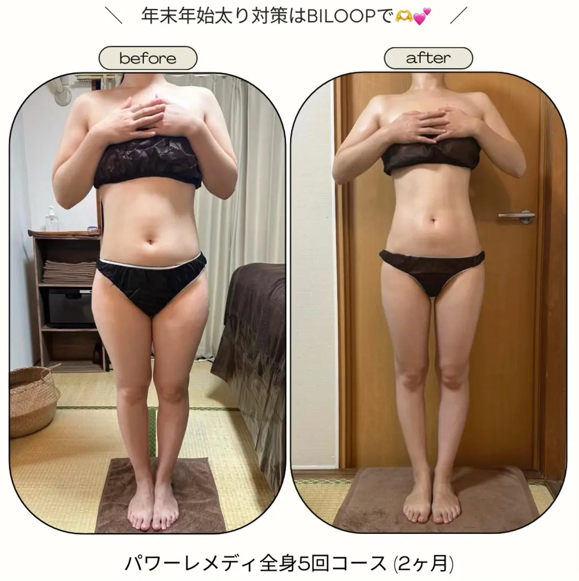 《本気痩せ×疲労改善 》  BILOOPのエステ・リラクイメージ