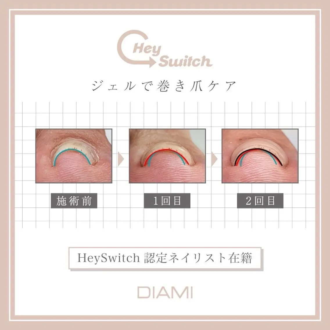 BellaLuna NAILのネイルデザイン