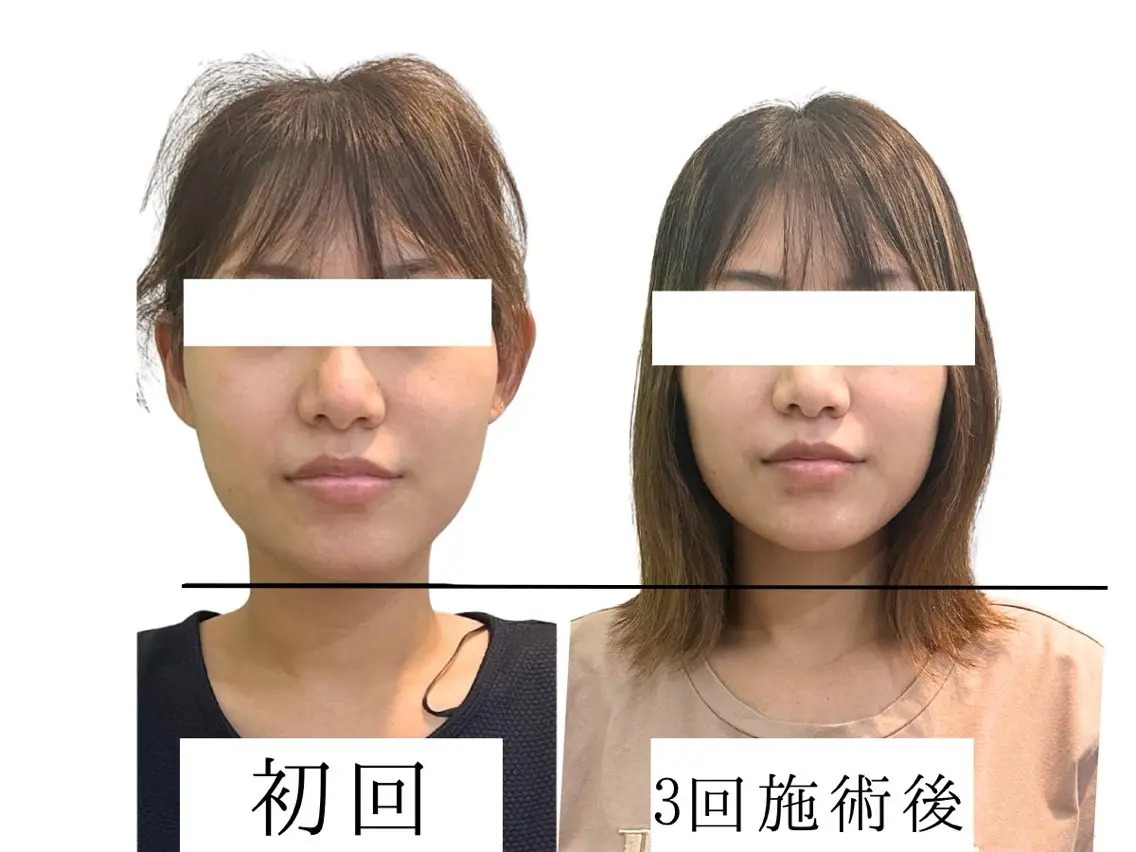 コアの木整骨院高津院 藤内尚志のエステ・リラクイメージ
