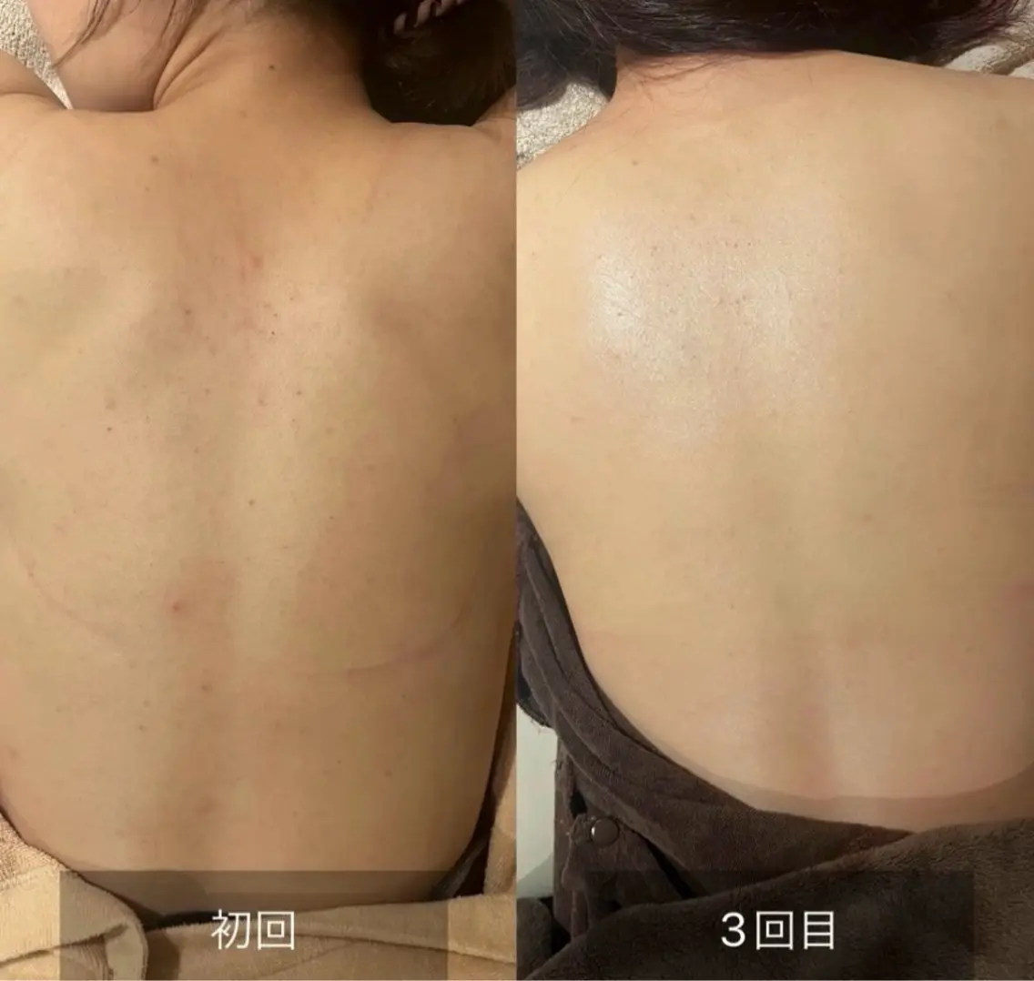 エステ 森 美優のエステ・リラクイメージ