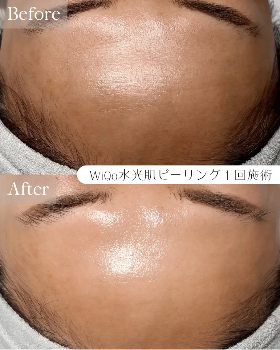 エステ ルコル池袋【毛穴洗浄 /wax顔脱毛】えみのエステ・リラクイメージ